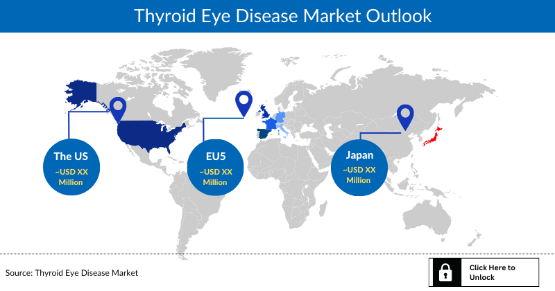 Thyroid Eye Disease Market Size Share Thyroid Eye Disease Market