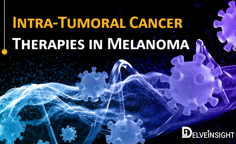 Intra-Tumoral Cancer Therapies in Melanoma