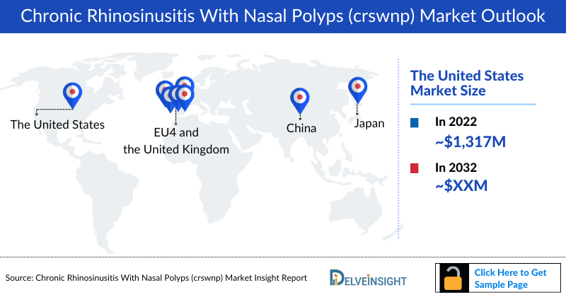 Chronic Rhinosinusitis With Nasal Polyps (crswnp) Market Outlook