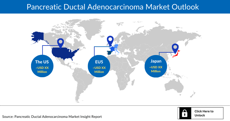 Pancreatic Ductal Adenocarcinoma Market Outlook