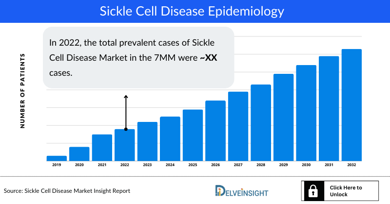 Sickle Cell Disease Epidemiology