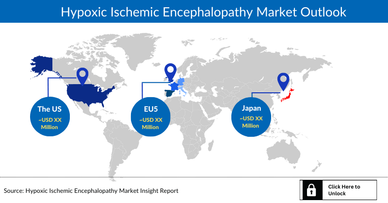 Hypoxic-Ischemic Encephalopathy - Infographics and Images