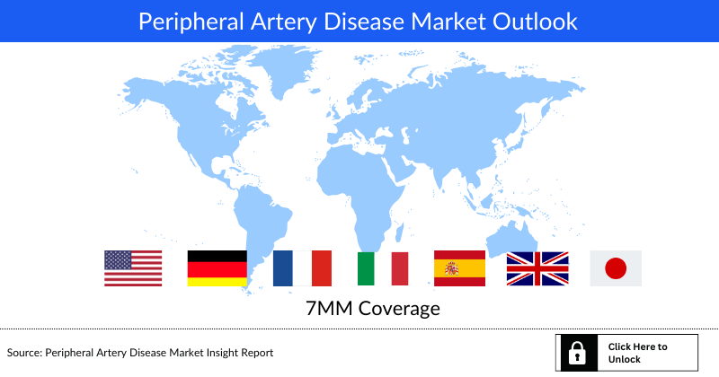 Peripheral Artery Disease Market Outlook