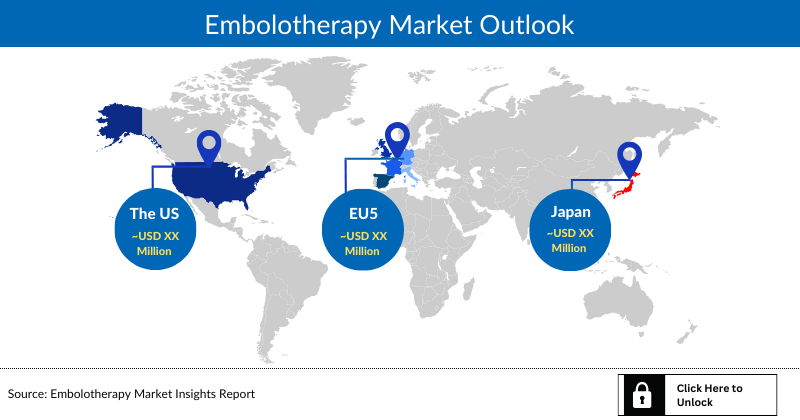 Embolotherapy Market Outlook
