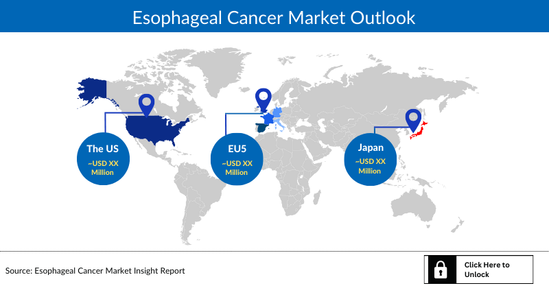 Esophageal Cancer Market Outlook