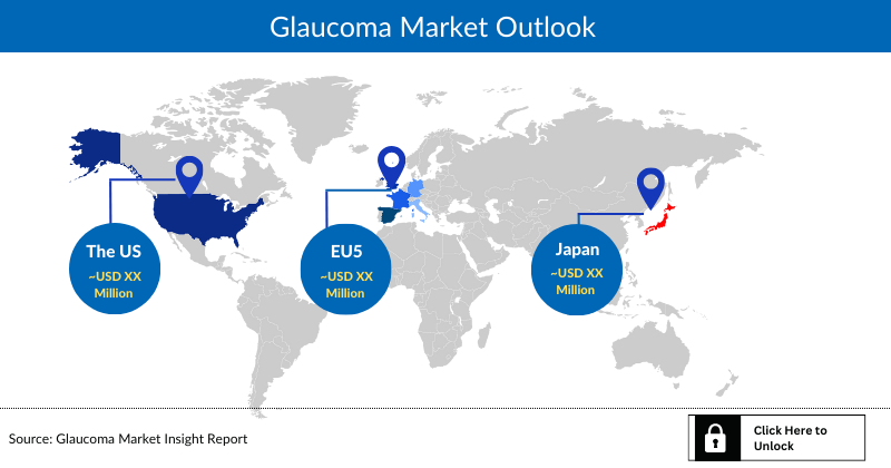 Glaucoma Market Outlook