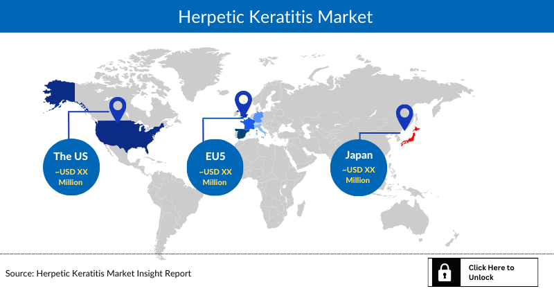 Herpetic Keratitis Market Outlook