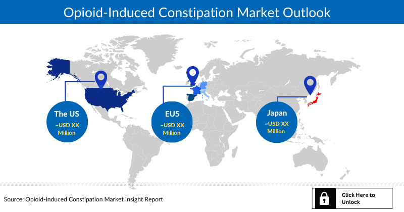 Opioid Induced Constipation Market Outlook