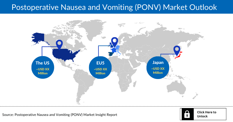 Postoperative Nausea and Vomiting (PONV) Market Outlook