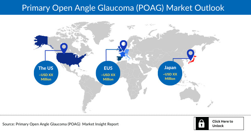 Primary Open Angle Glaucoma (POAG) Market Outlook