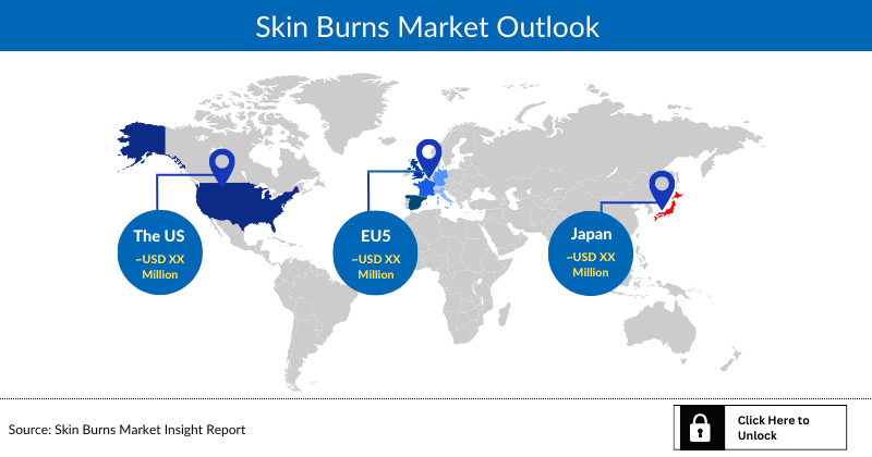 Skin Burns Market Outlook