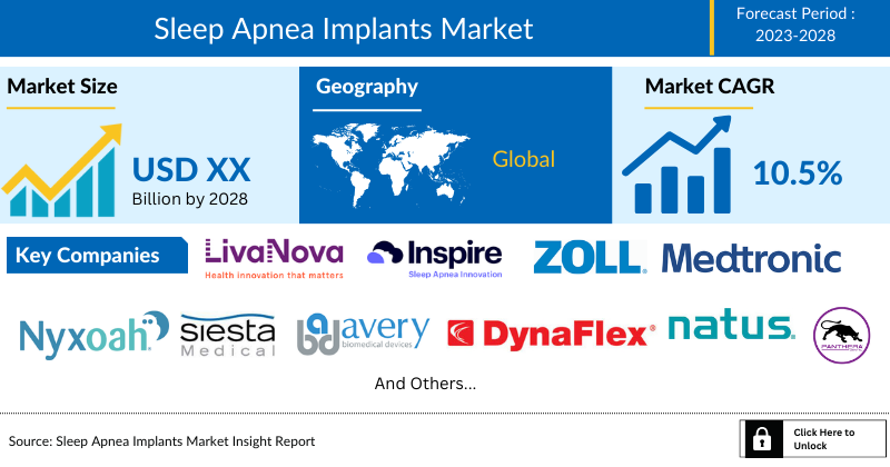 Sleep Apnea Implants Market