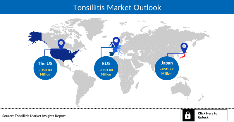 Tonsillitis Market Outlook
