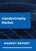 DelveInsight Market Research Report
