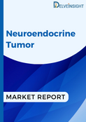 Neuroendocrine Tumors Market
