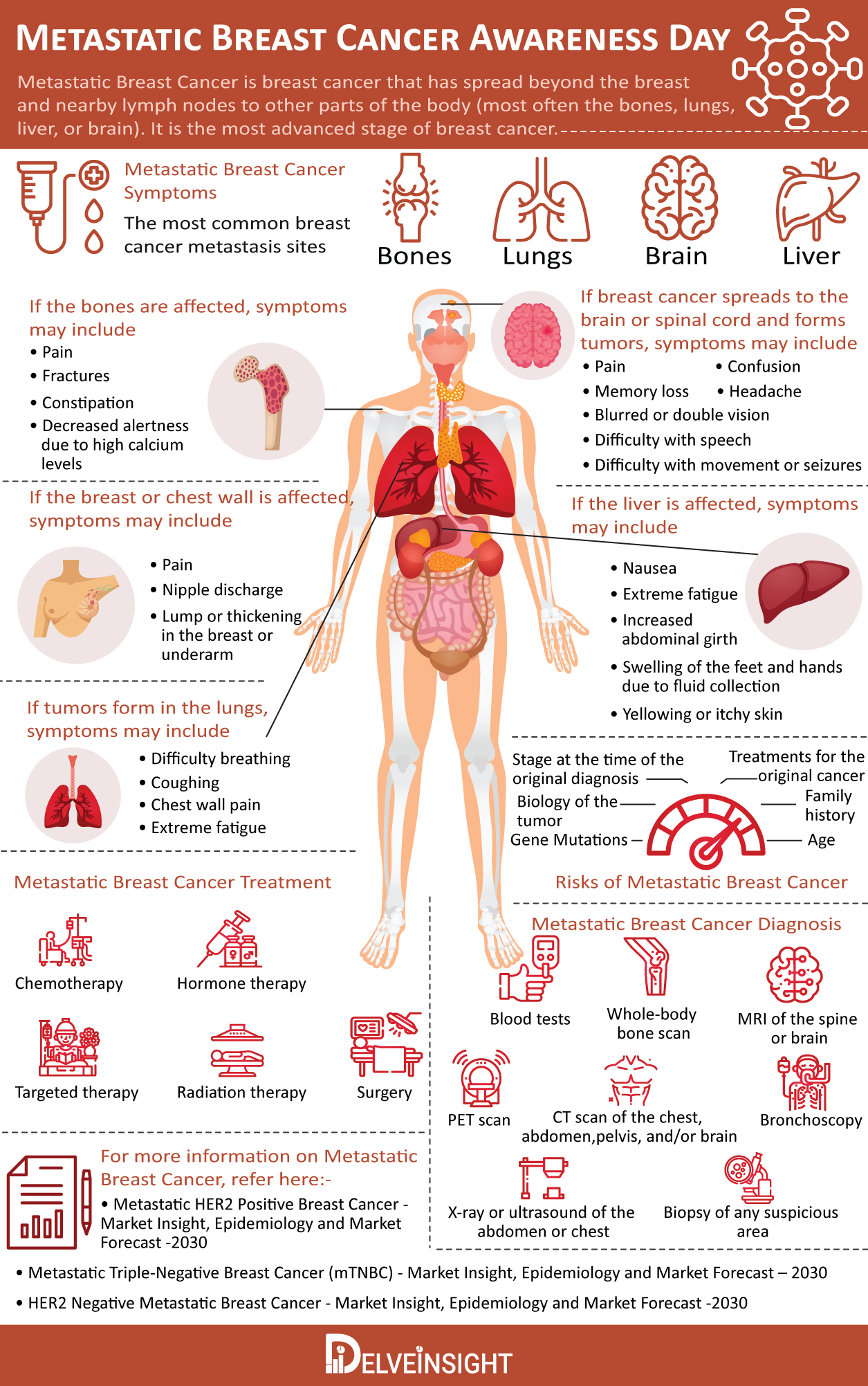 metastatic-breast-cancer-infographic